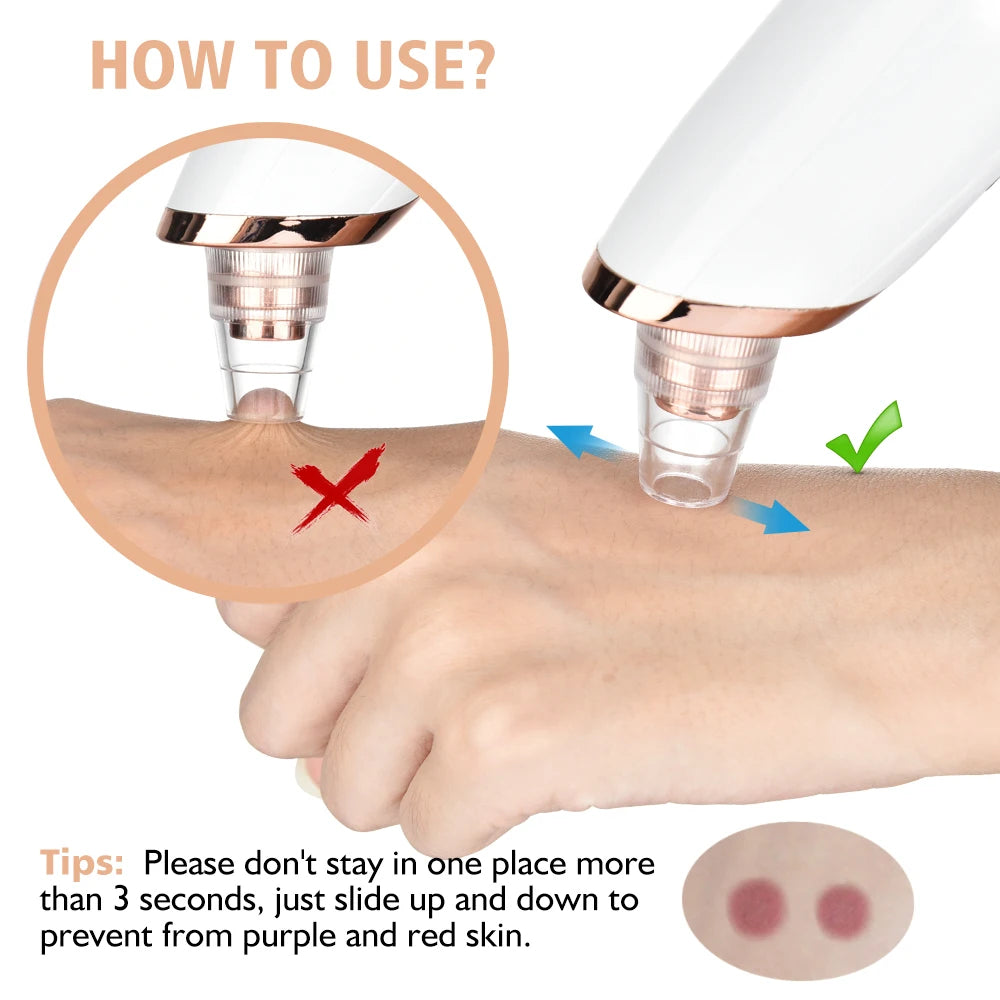 Deep Pore Cleaning With Powerful Vacuum Suction Removes Blackheads, Acne & Excess Facial Oil Easily Rechargeable & Portable Design For Everyday Skin Care
